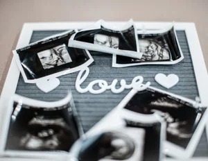 D 4D insight in Perth: what to expect from modern baby scans D 4D insight in Perth: what to expect from modern baby scans