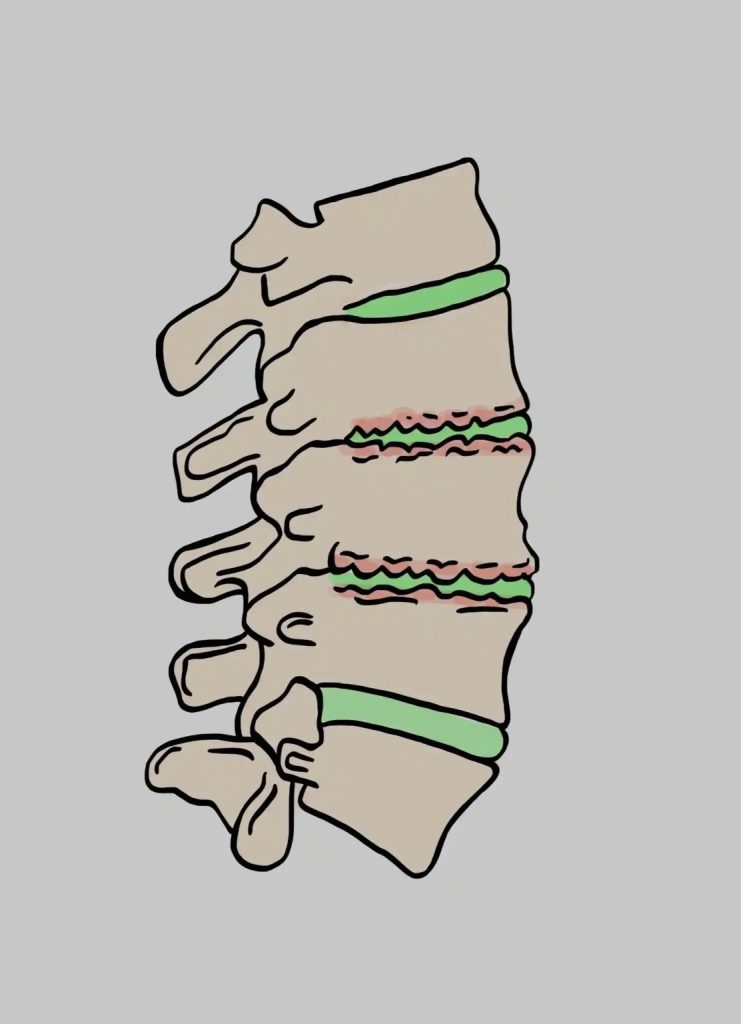 Untangling muscle knots with practical soft tissue care