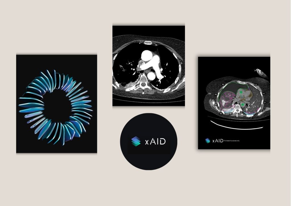 How to Choose Trusted AI Radiology Reporting Partners