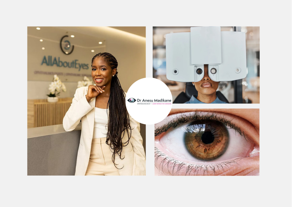Benefits of Laser Vision Correction for Astigmatism
